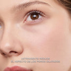 Loción de Hamamelis